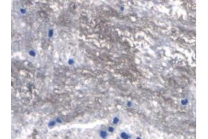 IHC-P analysis of Rat Spinal cord Tissue, with DAB staining. (RANKL antibody  (AA 106-240))