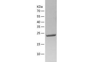 Western Blotting (WB) image for Glycolipid Transfer Protein (GLTP) (AA 1-209) protein (His tag) (ABIN7289142) (GLTP Protein (AA 1-209) (His tag))