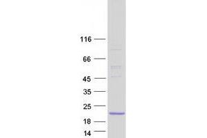 Interferon Induced Transmembrane Protein 10 (IFITM10) protein (Myc-DYKDDDDK Tag)