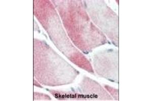 Formalin-fixed and paraffin-embedded human Skeletal Muscle tissue reacted with JMJD3 Antibody (C-term) (ABIN387863 and ABIN2844040) , which was peroxidase-conjugated to the secondary antibody, followed by AEC staining. (Kdm6b antibody  (C-Term))