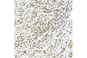 Immunohistochemistry (IHC) image for anti-Transcription Factor 7 (T-Cell Specific, HMG-Box) (TCF7) antibody (ABIN7270885)