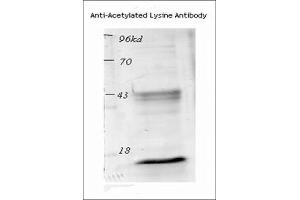 Western blot analysis of Mouse Spleen lysates showing detection of Acetylated Lysine protein using Rabbit Anti-Acetylated Lysine Polyclonal Antibody . (Lysine (lys) (acetylated) antibody (PerCP))