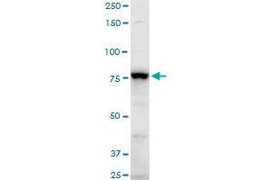 ADD3 polyclonal antibody (A01), Lot # CHI0060725QCS1. (ADD3 antibody  (AA 462-560))