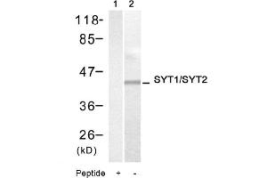 Image no. 1 for anti-Synaptotagmin I (SYT1) (Thr199), (Thr202) antibody (ABIN319341)