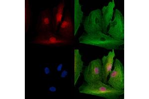 ABIN7094778 and ABIN7098829 staining  cells by IF/ICC. (SSRP1 antibody  (Internal Region))
