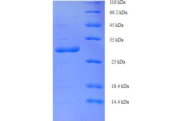 Vpx Protein (VPX) (AA 1-112), (full length) protein (His-SUMO Tag)