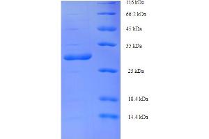 SDS-PAGE (SDS) image for Vpx Protein (VPX) (AA 1-112), (full length) protein (His-SUMO Tag) (ABIN5710778)