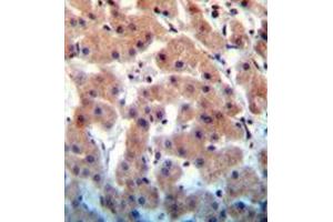 Immunohistochemistry analysis in formalin fixed and paraffin embedded human liver tissue reacted with INHBB Antibody (C-term) followed by peroxidase conjugation of the secondary antibody and DAB staining. (INHBB antibody  (C-Term))