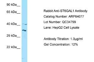 Western Blotting (WB) image for anti-ST6 beta-Galactosamide alpha-2,6-Sialyltranferase 1 (ST6GAL1) (N-Term) antibody (ABIN971799) (ST6GAL1 antibody  (N-Term))