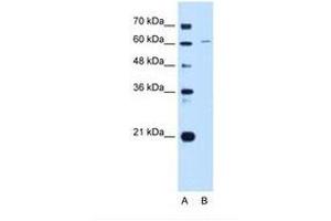 Image no. 1 for anti-Chromatin Licensing and DNA Replication Factor 1 (CDT1) (AA 400-449) antibody (ABIN6739459) (CDT1 antibody  (AA 400-449))