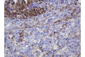 FNDC4 antibody