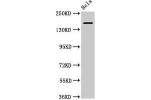 Western Blot Positive WB detected in: Hela whole cell lysate All lanes: ROBO1 antibody at 3. (ROBO1 antibody  (AA 29-143))