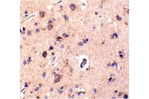 Immunohistochemistry (IHC) image for anti-C1q and Tumor Necrosis Factor Related Protein 2 (C1QTNF2) (Middle Region) antibody (ABIN1030911) (C1QTNF2 antibody  (Middle Region))
