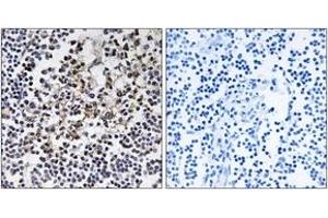 Immunohistochemistry analysis of paraffin-embedded human lymph node tissue, using PGLS Antibody. (PGLS antibody  (AA 191-240))