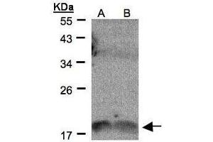 WB Image Sample(30 μg of whole cell lysate) A:H1299 B:HeLa S3, 12% SDS PAGE antibody diluted at 1:500 (IL1F9 antibody  (C-Term))