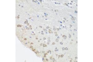 Immunohistochemistry of paraffin-embedded mouse brain using PUM1 antibody at dilution of 1:100 (40x lens). (PUM1 antibody)