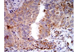 Immunohistochemistry (IHC) image for anti-Toll-Like Receptor 9 (TLR9) (AA 868-1016) antibody (ABIN5896728) (TLR9 antibody  (AA 868-1016))