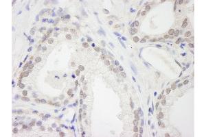 Immunohistochemistry (IHC) image for anti-RNA Binding Motif Protein 12 (RBM12) (AA 625-675) antibody (ABIN7448760) (RBM12 antibody  (AA 625-675))