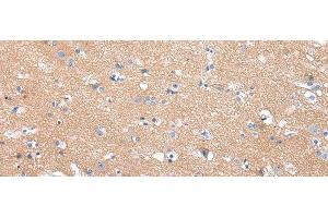 Immunohistochemistry of paraffin-embedded Human brain tissue using COLEC12 Polyclonal Antibody at dilution 1:40 (COLEC12 antibody)