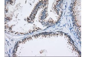 Immunohistochemical staining of paraffin-embedded Human Kidney tissue using anti-MOBKL1A mouse monoclonal antibody.