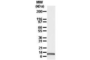 Image no. 1 for anti-Phorbol-12-Myristate-13-Acetate-Induced Protein 1 (PMAIP1) antibody (ABIN187551) (NOXA antibody)