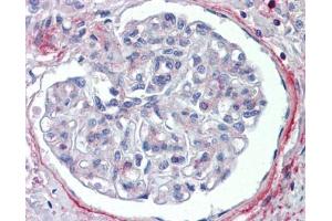 PODXL antibody was used for immunohistochemistry at a concentration of 4-8 ug/ml. (PODXL antibody  (Middle Region))