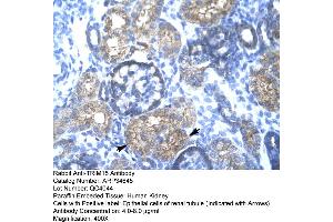 Human kidney (TRIM15 antibody  (N-Term))