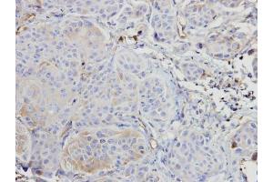 Immunohistochemistry (IHC) image for anti-V-Raf Murine Sarcoma 3611 Viral Oncogene Homolog (ARAF) (C-Term) antibody (ABIN2855039)
