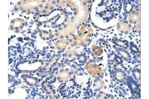 Image no. 1 for anti-EMG1 Nucleolar Protein Homolog (EMG1) (AA 51-100) antibody (ABIN6736233) (EMG1 antibody  (AA 51-100))