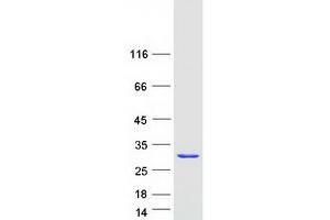 Validation with Western Blot