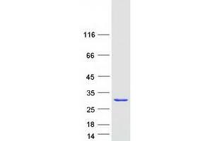 Validation with Western Blot (RAB2B Protein (Myc-DYKDDDDK Tag))