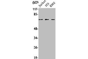 Western Blot analysis of Jurkat NIH-3T3 K562 cells using SENP1 Polyclonal Antibody (SENP1 antibody  (N-Term))