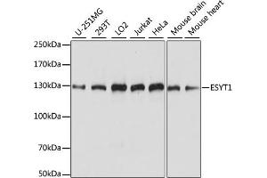 Western blot analysis of extracts of various cell lines, using ESYT1 antibody (ABIN7267069) at 1:1000 dilution. (ESYT1 antibody  (AA 90-220))