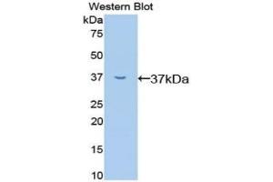 Detection of Recombinant RELA, Mouse using Polyclonal Antibody to Transcription Factor P65 (NFKB3) (NF-kB p65 antibody  (AA 19-306))