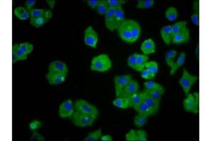 Immunofluorescence staining of HepG2 cells with ABIN7173341 at 1:66, counter-stained with DAPI. (TREH antibody  (AA 373-507))