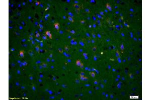 Formalin-fixed and paraffin-embedded rat brain labeled with Anti-Phospho-NMDAR2B (Tyr1336) Polyclonal Antibody, Unconjugated (ABIN801228) 1:200, overnight at 4°C, The secondary antibody was Goat Anti-Rabbit IgG, Cy3 conjugated used at 1:200 dilution for 40 minutes at 37°C. (GRIN2B antibody  (pTyr1336))