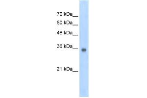 WB Suggested Anti-SOX2 Antibody Titration:  2. (SOX2 antibody  (N-Term))