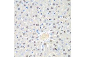 Immunohistochemistry (Paraffin-embedded Sections) (IHC (p)) image for anti-WD Repeat Domain 48 (WDR48) (AA 450-677) antibody (ABIN6150198)