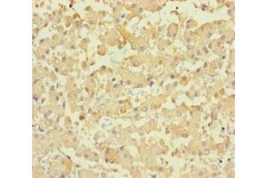 Immunohistochemistry of paraffin-embedded human liver tissue using ABIN7158418 at dilution of 1:100 (LPPR2 antibody  (AA 1-156))