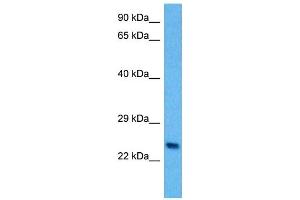 Host:  Mouse  Target Name:  PLP1  Sample Tissue:  Mouse Spleen  Antibody Dilution:  1ug/ml (PLP1 antibody  (N-Term))