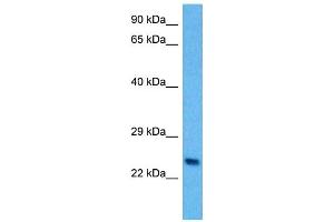 Host:  Mouse  Target Name:  PLP1  Sample Tissue:  Mouse Spleen  Antibody Dilution:  1ug/ml (PLP1 antibody  (N-Term))