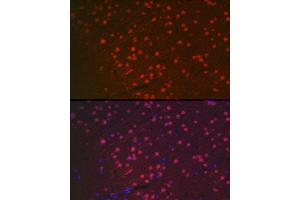 Immunofluorescence (IF) image for anti-RNA Binding Protein, Fox-1 Homolog 3 (RBFOX3) (AA 1-220) antibody (ABIN1513254)