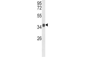 Western Blotting (WB) image for anti-Kruppel-Like Factor 6 (KLF6) antibody (ABIN5022570) (KLF6 antibody)