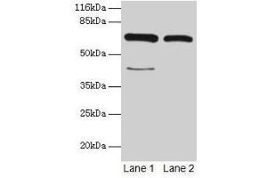 Western blot All lanes: CTPS1 antibody at 6 μg/mL Lane 1: Hela whole cell lysate Lane 2: 293T whole cell lysate Secondary Goat polyclonal to rabbit IgG at 1/10000 dilution Predicted band size: 67, 42 kDa Observed band size: 67 kDa