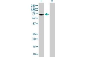 Western Blot analysis of MMP13 expression in transfected 293T cell line by MMP13 MaxPab polyclonal antibody. (MMP13 antibody  (AA 1-471))