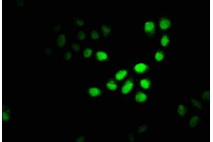 Immunofluorescence staining of Hela cells with ABIN7150950 at 1:100, counter-stained with DAPI. (CBX4 antibody  (AA 1-160))