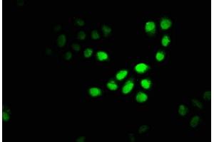 Immunofluorescence staining of Hela cells with ABIN7150950 at 1:100, counter-stained with DAPI.