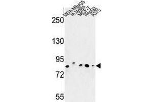 Western blot analysis of CHPF (arrow) in MDA-MB435, MCF-7, HepG2, A375 cell line and mouse testis tissue lysates (35ug/lane) using Chondroitin sulfate synthase 2 (CHPF antibody  (Middle Region))