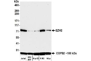 Western Blotting (WB) image for anti-Enhancer of Zeste Homolog 2 (EZH2) (C-Term) antibody (ABIN7795723)