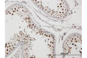 Immunoperoxidase of purified MaxPab antibody to C1orf25 on formalin-fixed paraffin-embedded human testis. (TRMT1L antibody  (AA 1-733))